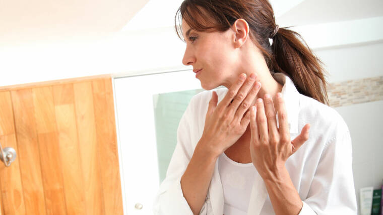 Cherry angiomer: Hudprikkene mange får i 40-årene